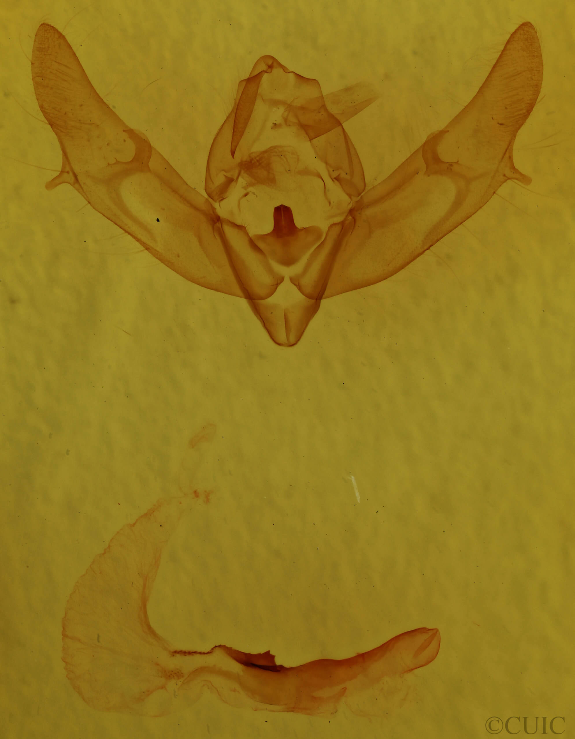 genitalia view of adult Xestia xanthographa