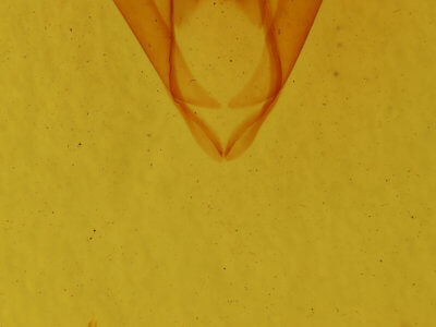 genitalia view of adult Zale bethunei