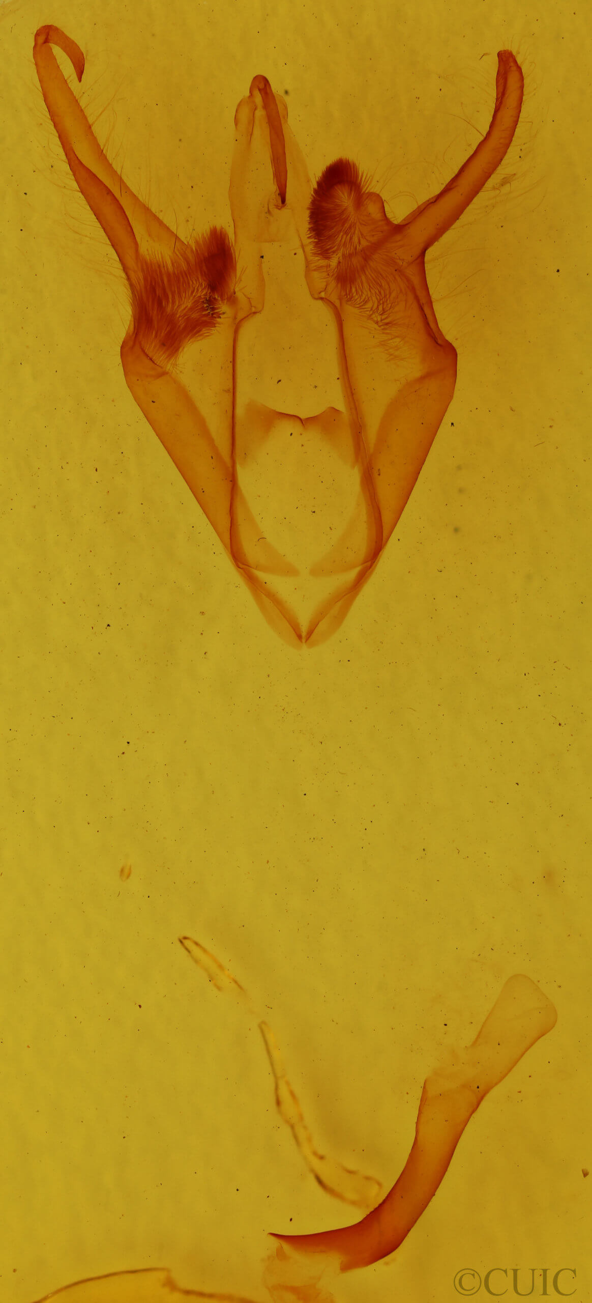 genitalia view of adult Zale bethunei