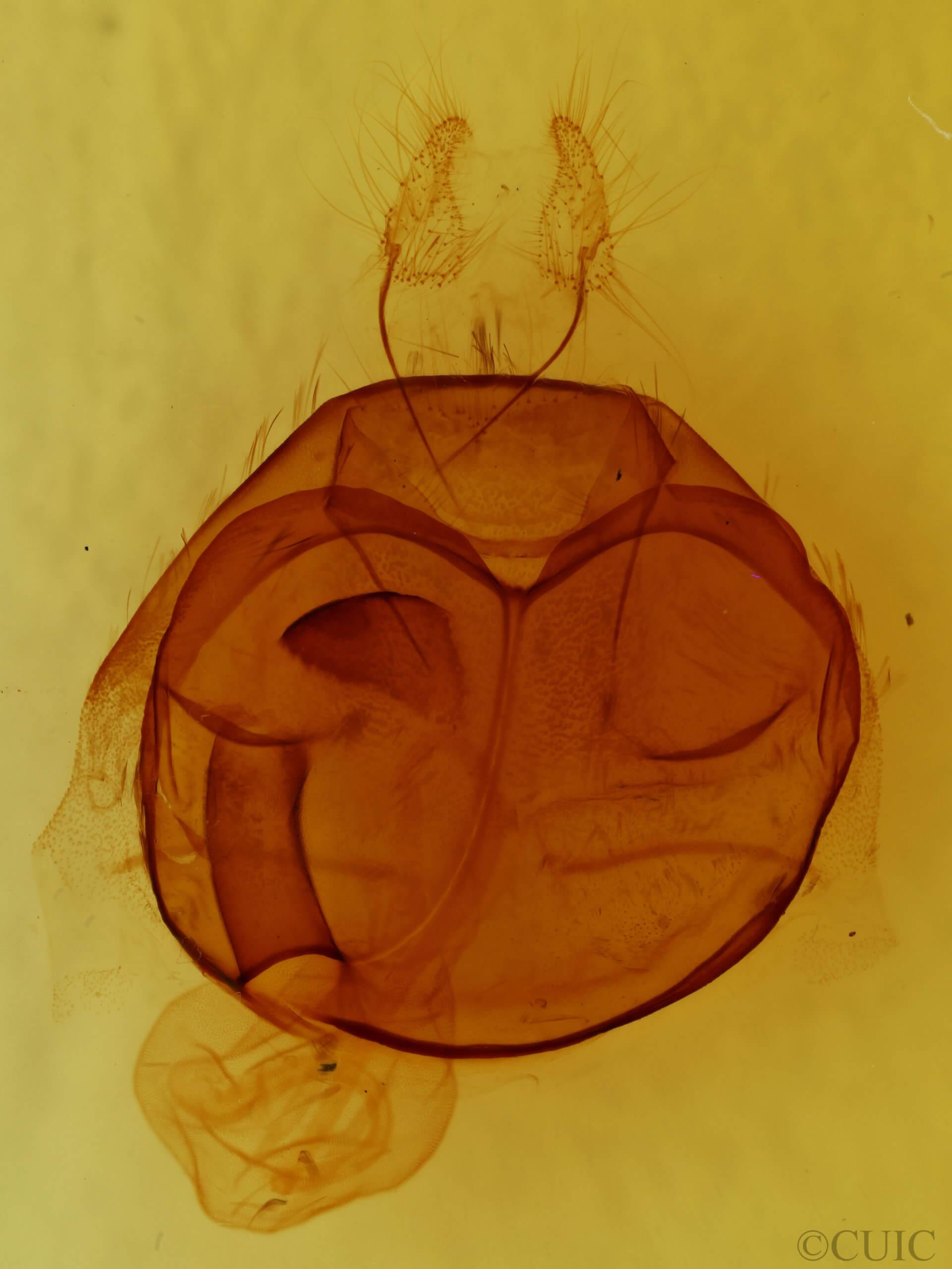 genitalia view of adult Zale buchholzi