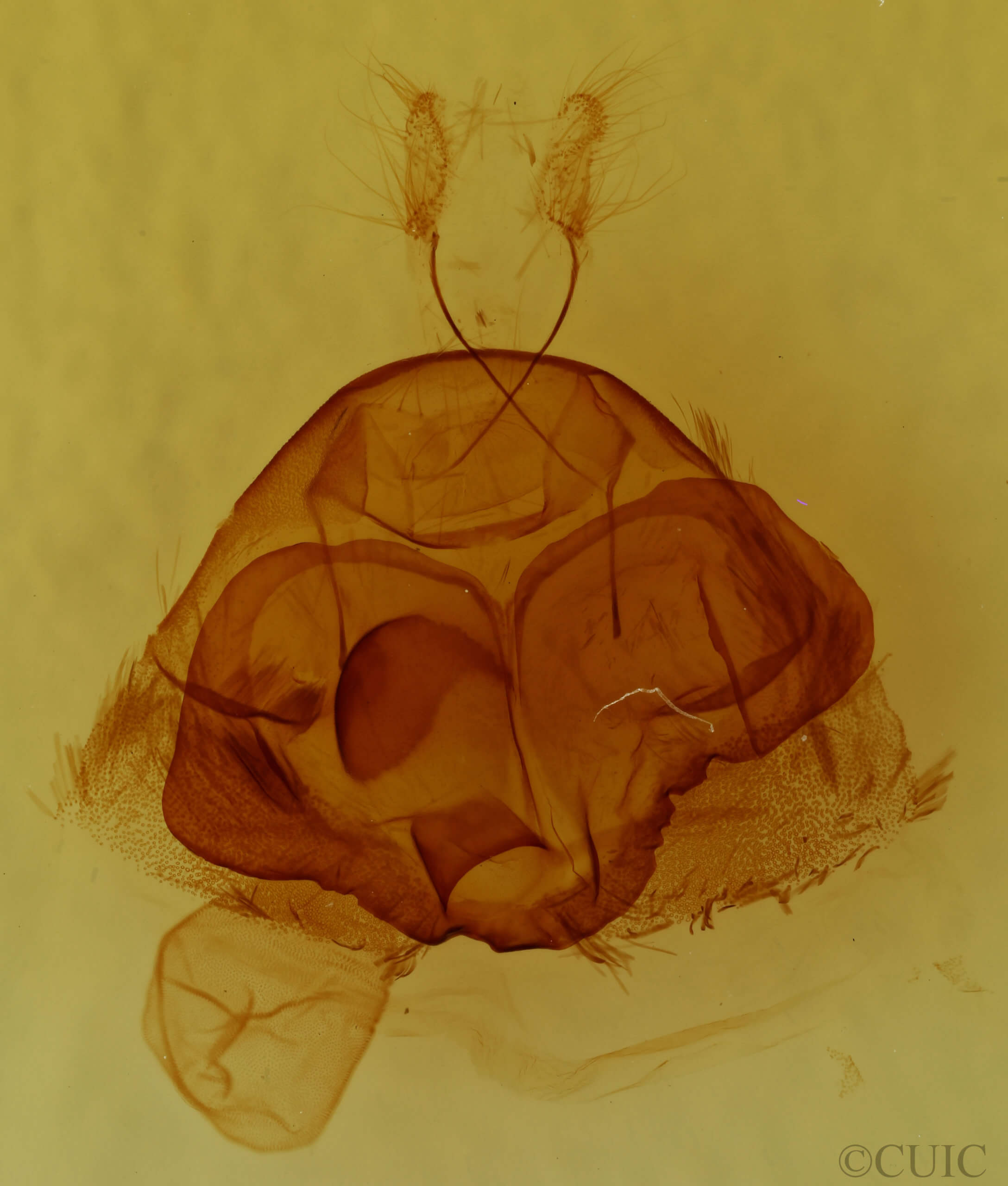 genitalia view of adult Zale curema