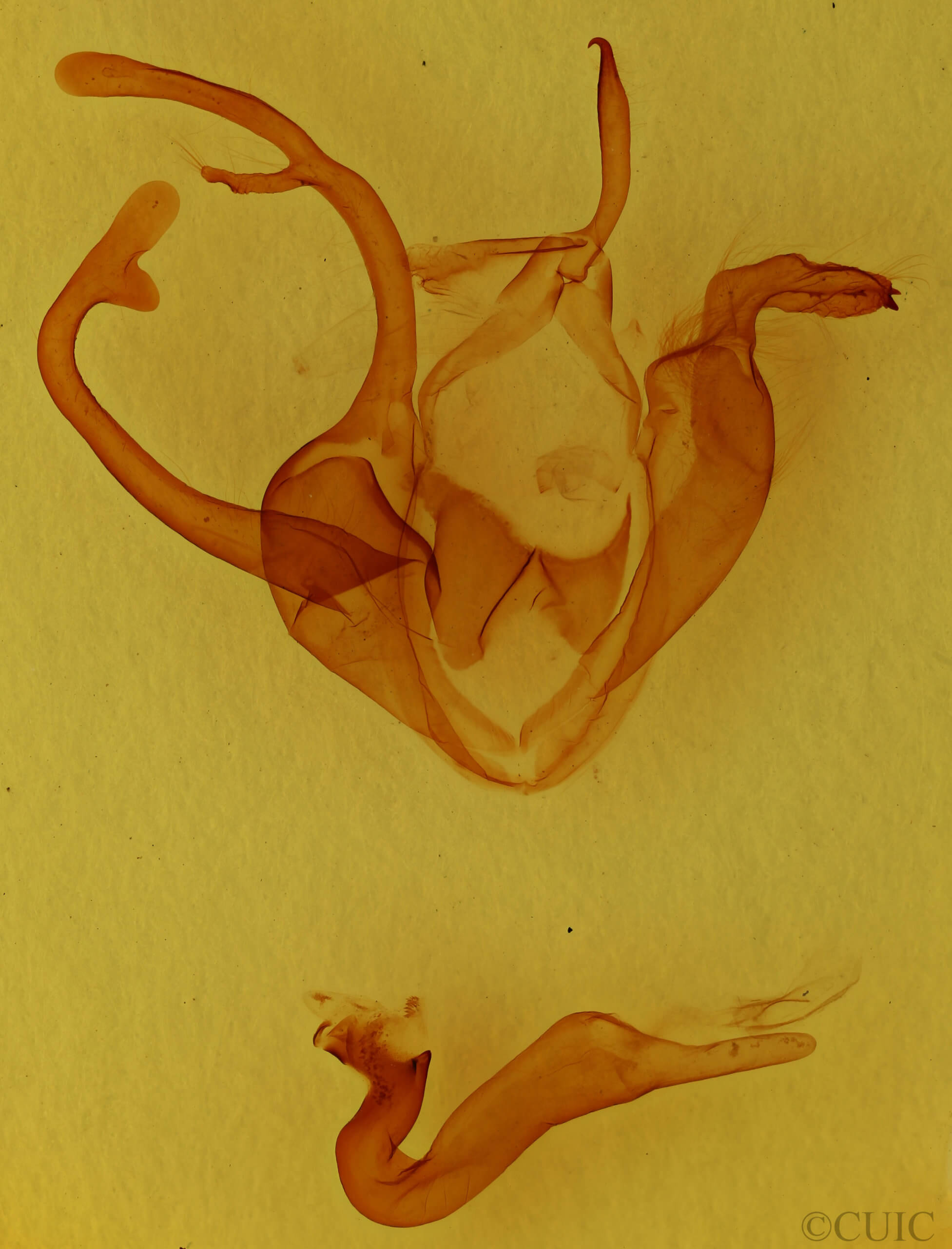 genitalia view of adult Zale lunata