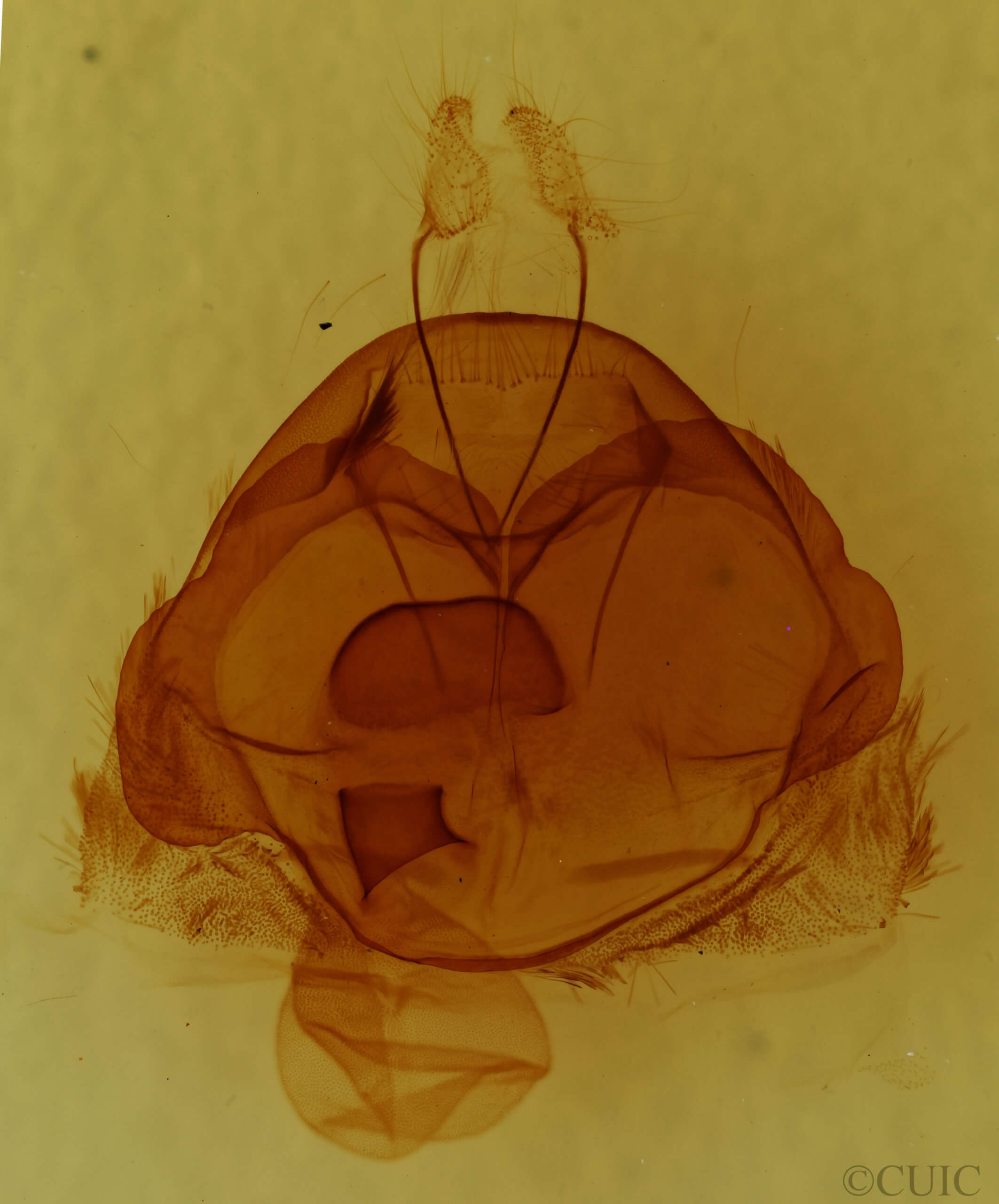 genitalia view of adult Zale metatoides