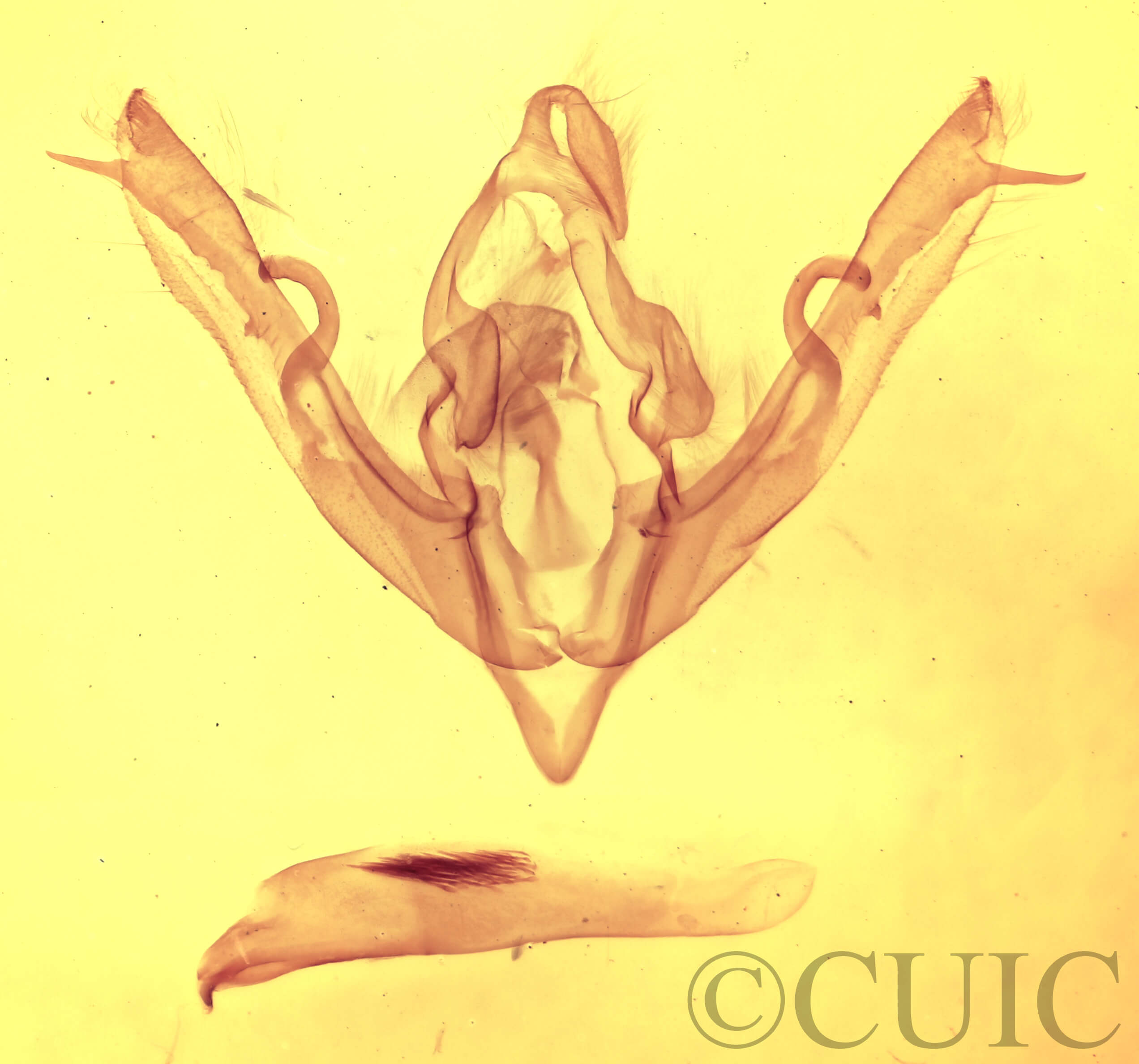 genitalia view of adult Lithophane signosa