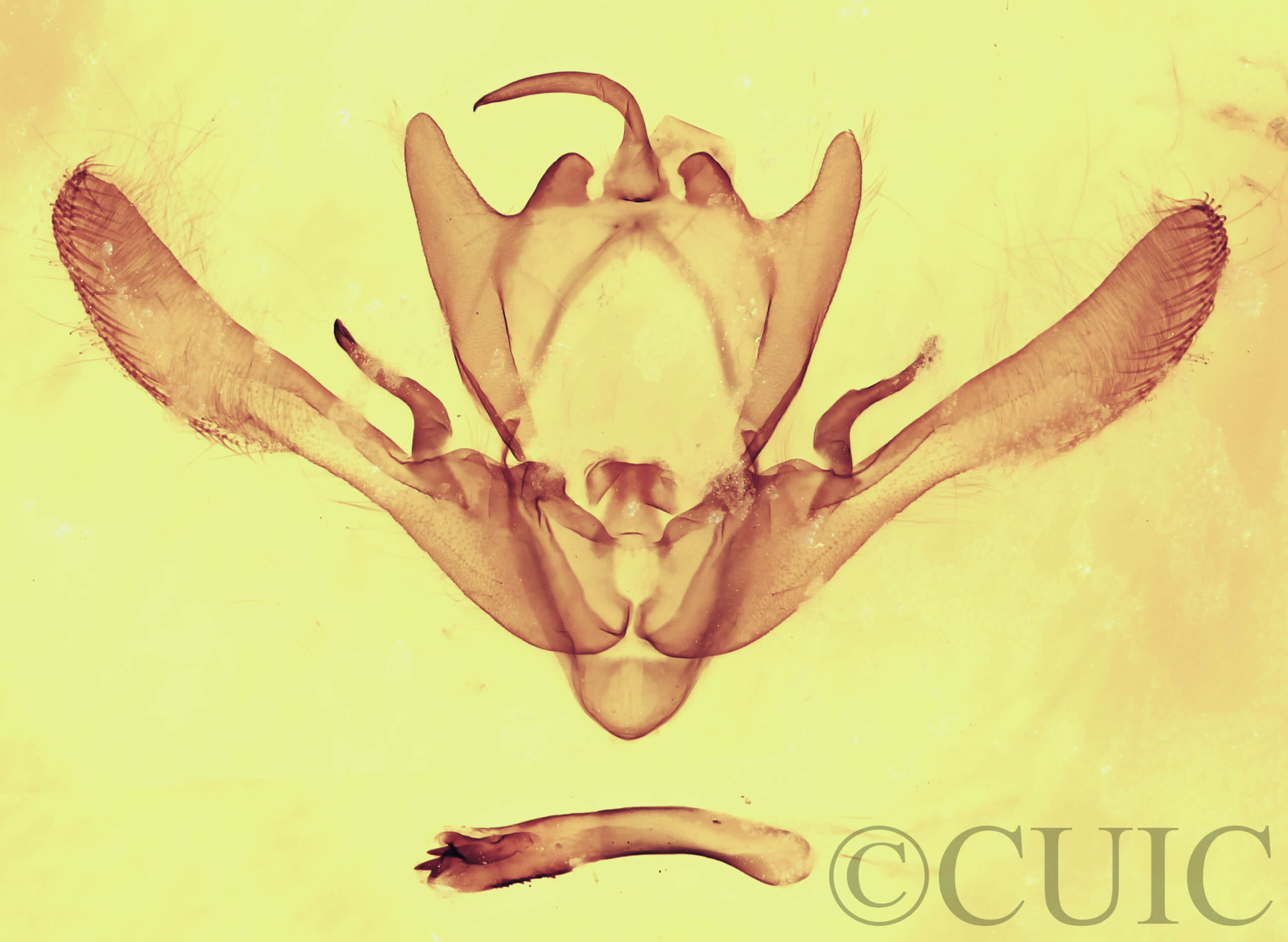 genitalia view of adult Enargia infumata