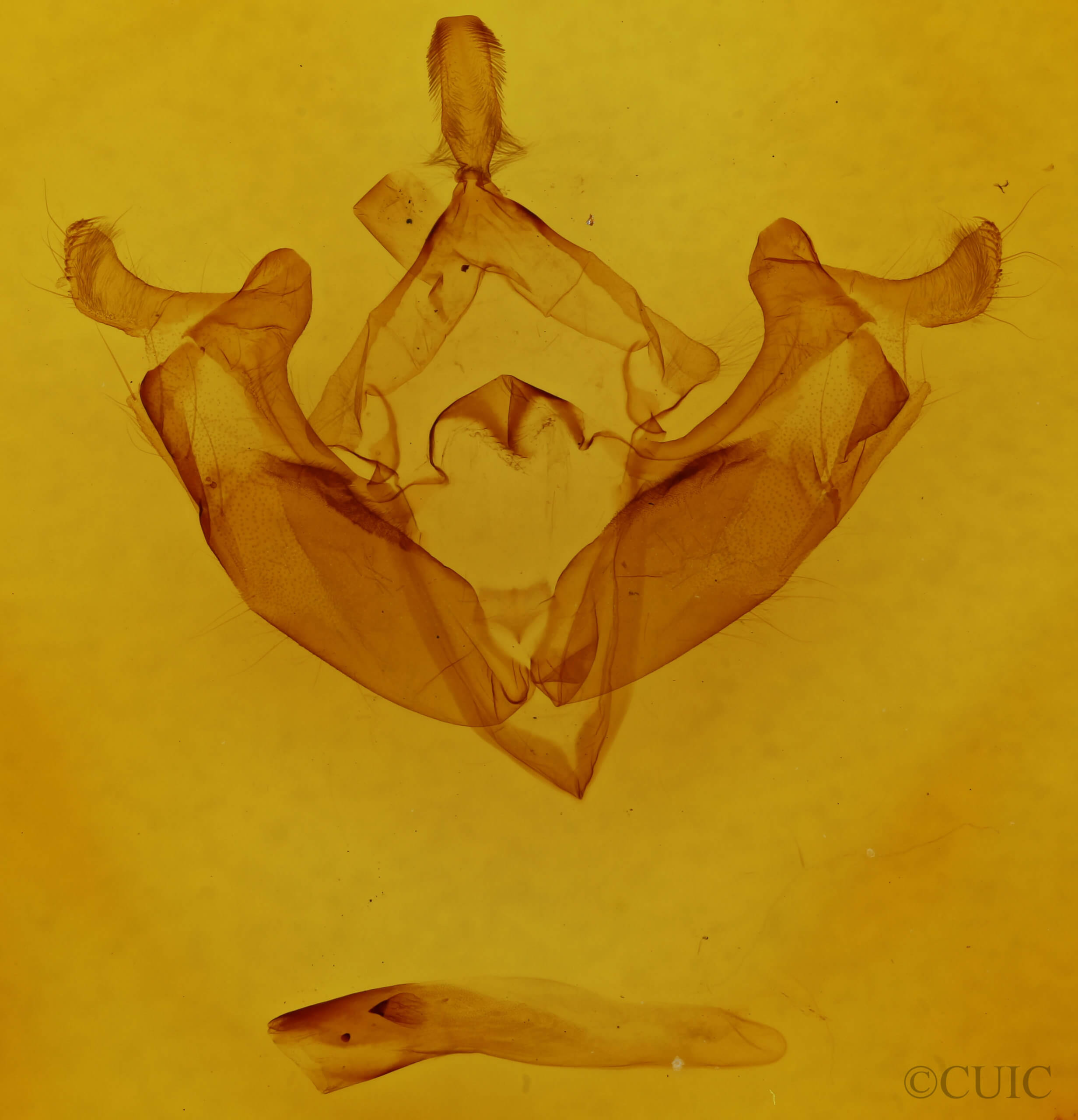 genitalia view of adult Admetovis similaris