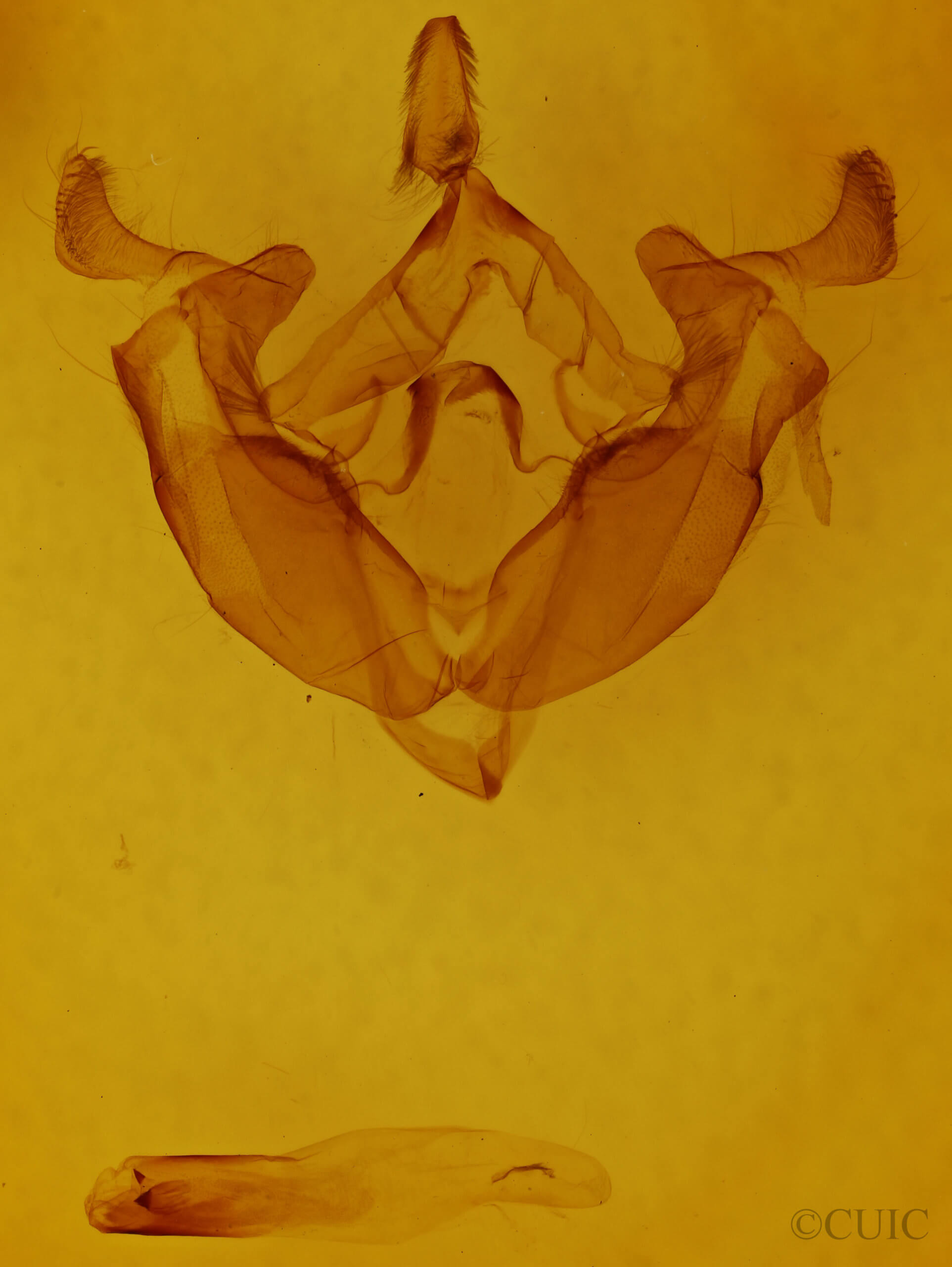 genitalia view of adult Admetovis similaris