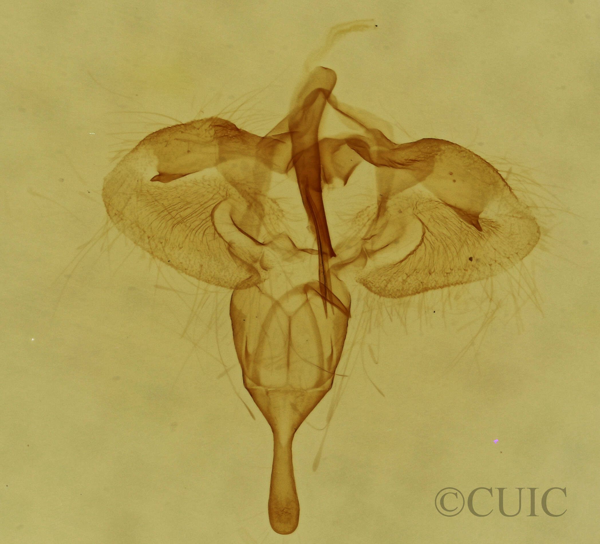 genitalia view of adult Archips georgiana