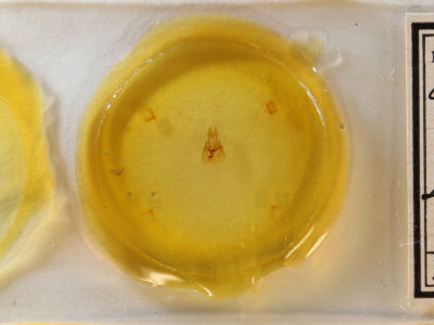 slide view of adult Neoligia inermis