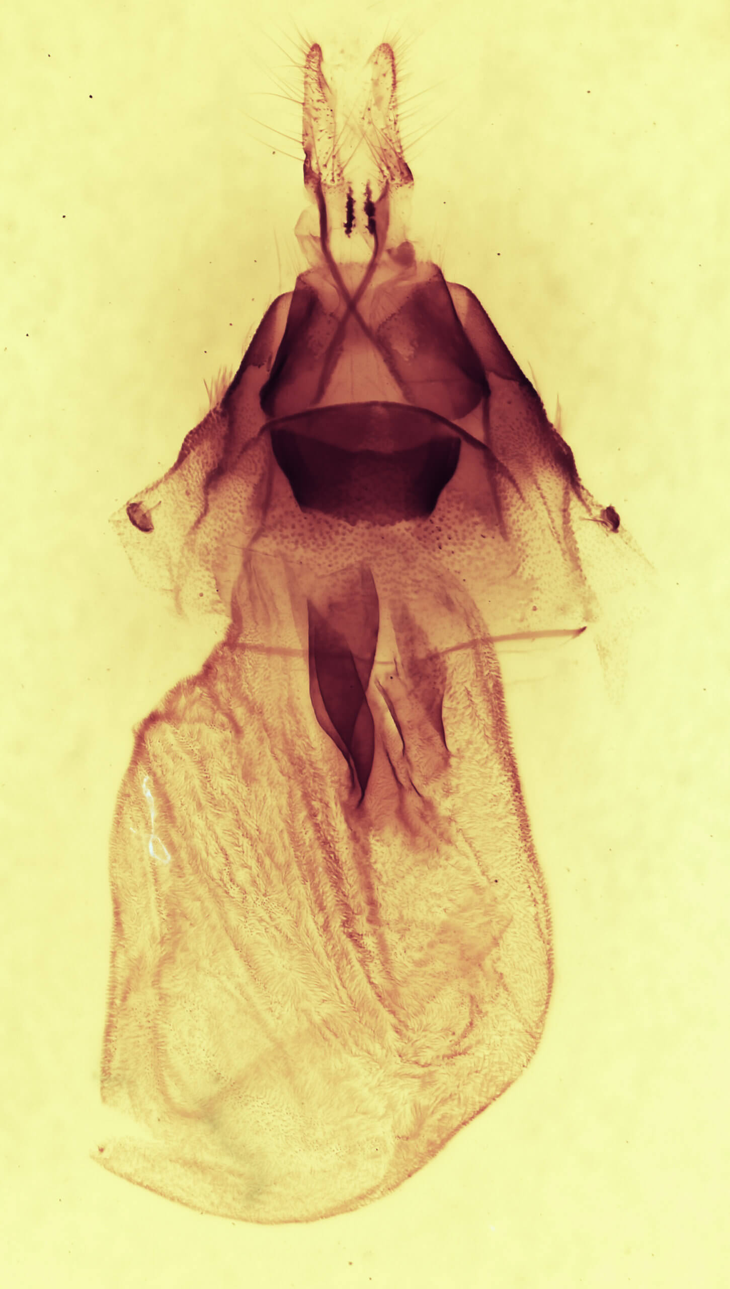 genitalia view of adult Synorthodes typhedana