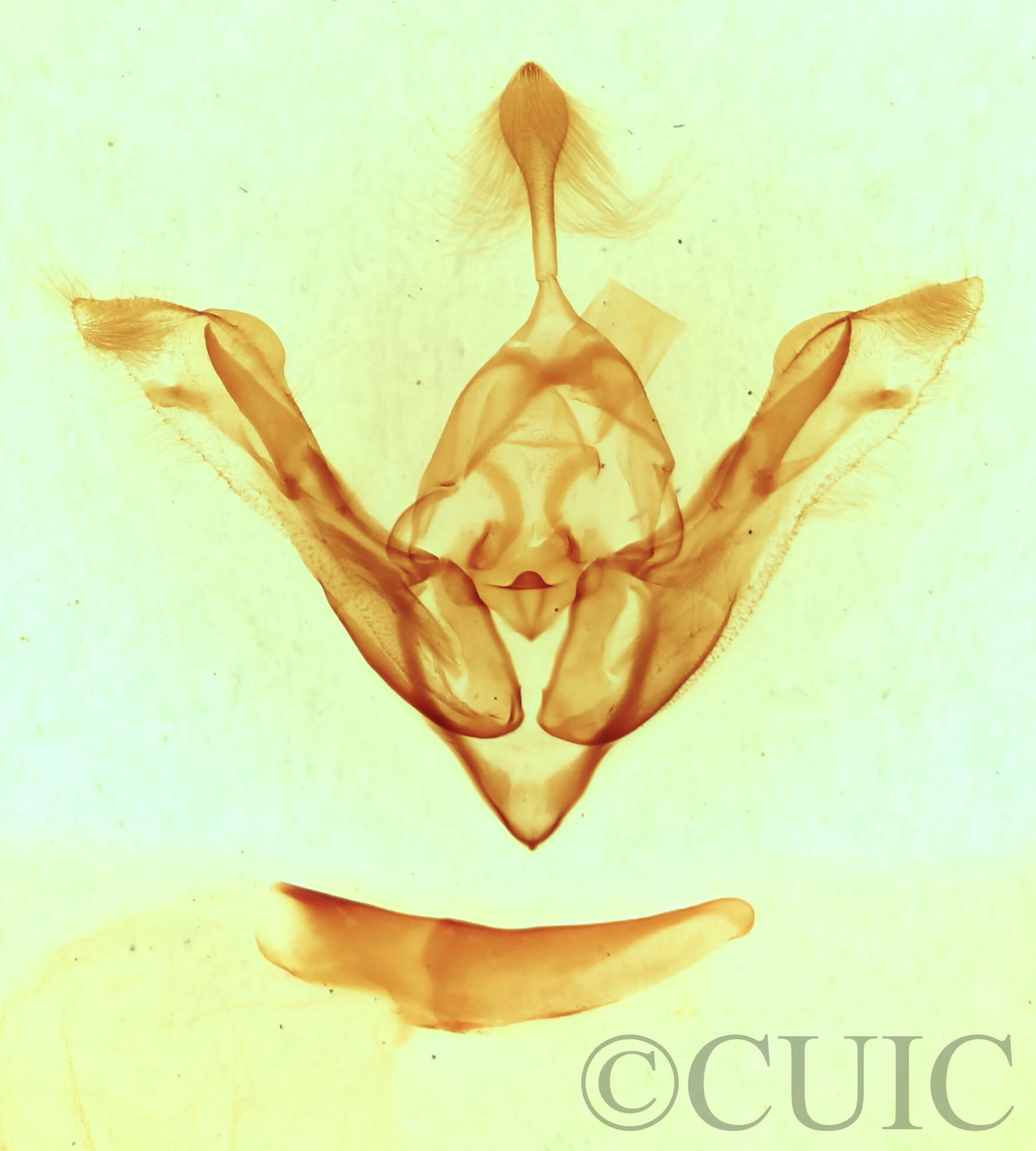 genitalia view of adult Synorthodes auriginea