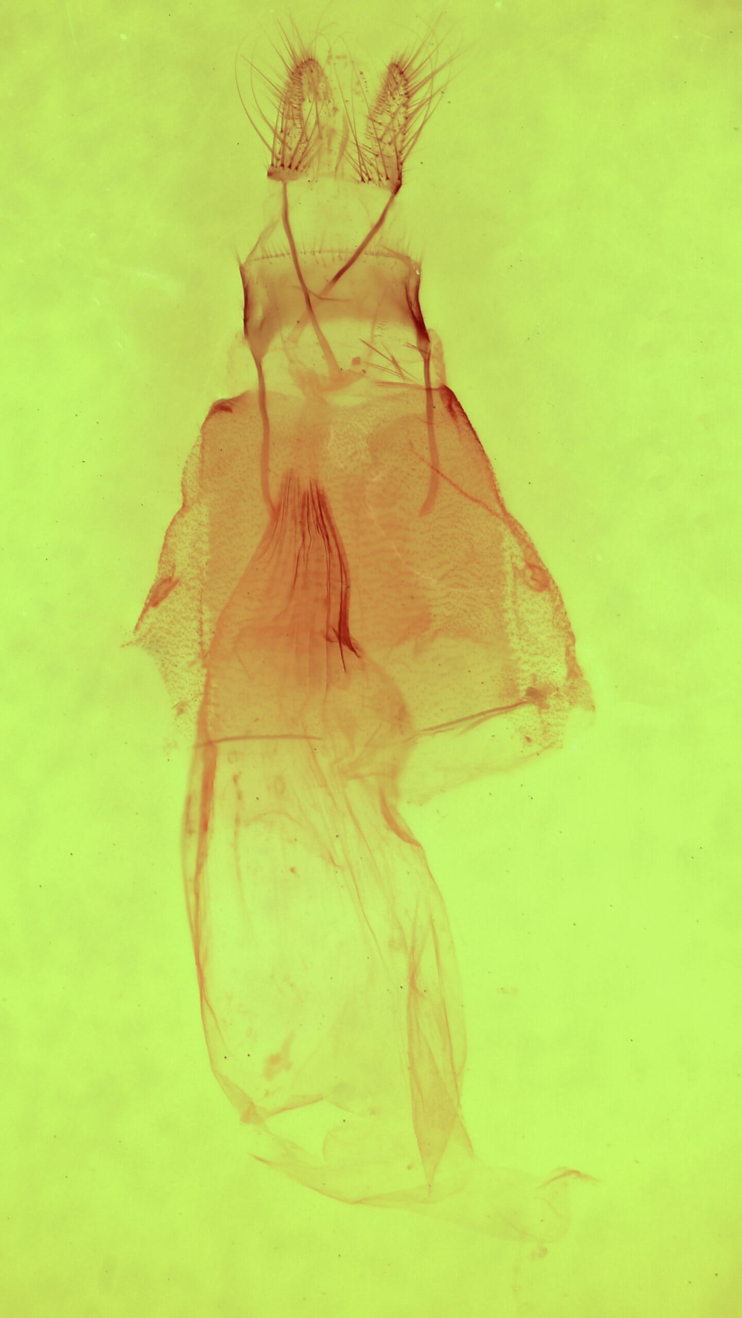 genitalia view of adult Apsaphida eremna