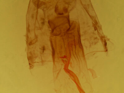 genitalia view of adult Lytrosis unitaria