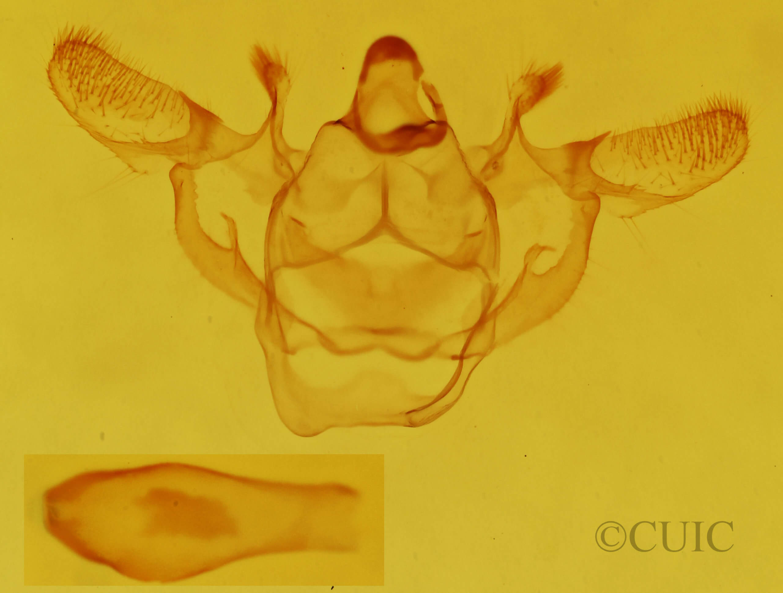 genitalia view of adult Xanthotype urticaria