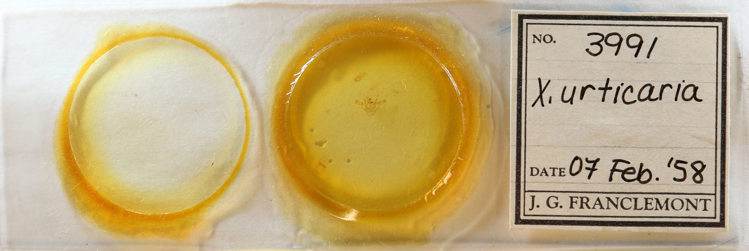 slide view of adult Xanthotype urticaria