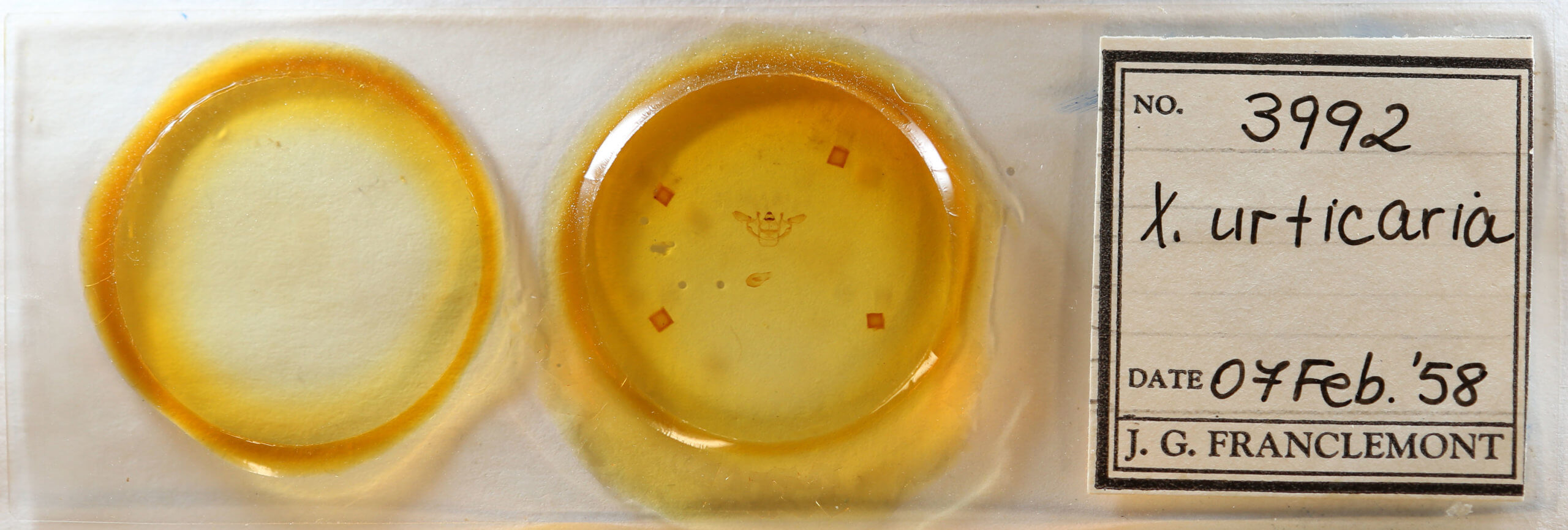 slide view of adult Xanthotype urticaria