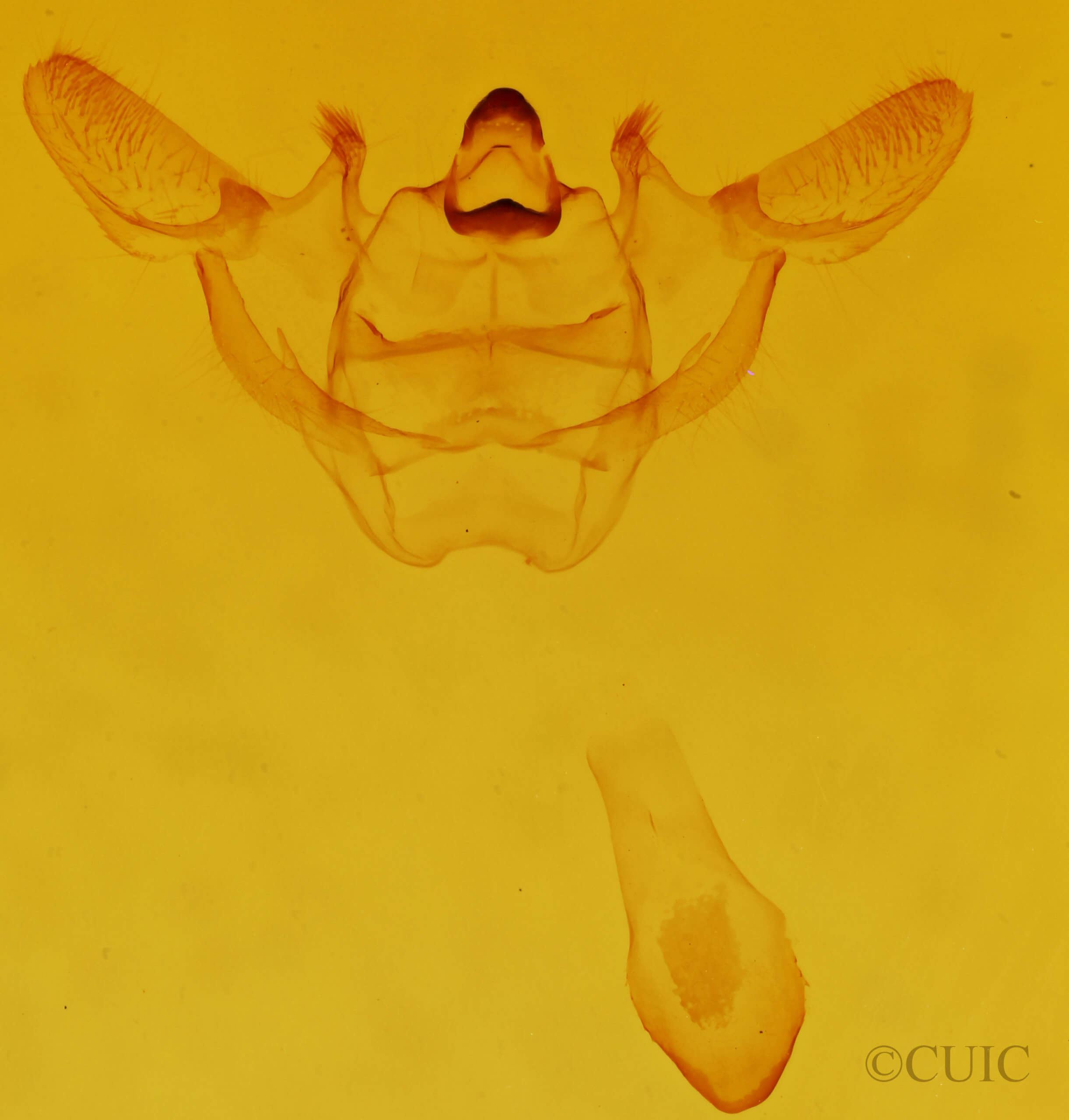 genitalia view of adult Xanthotype sospeta
