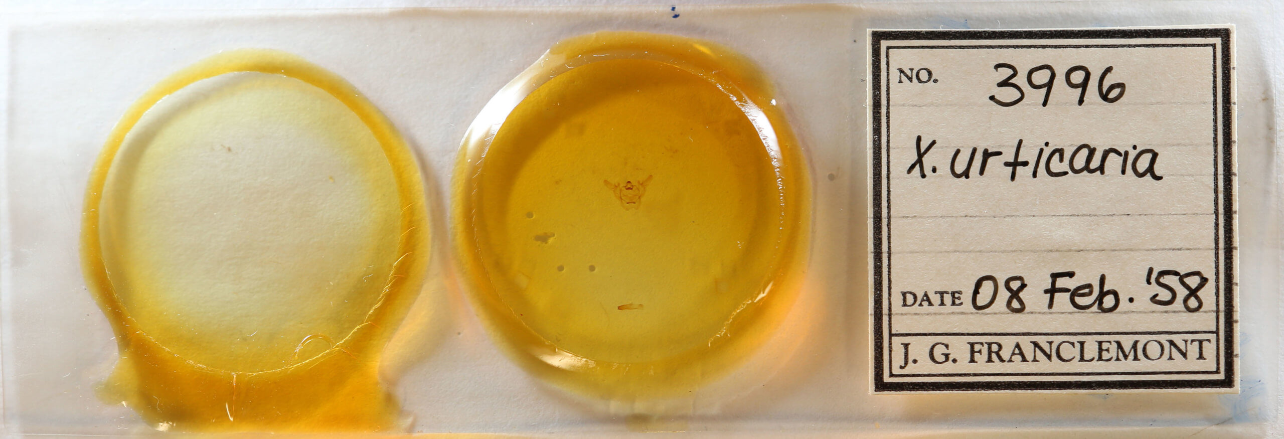 slide view of adult Xanthotype urticaria