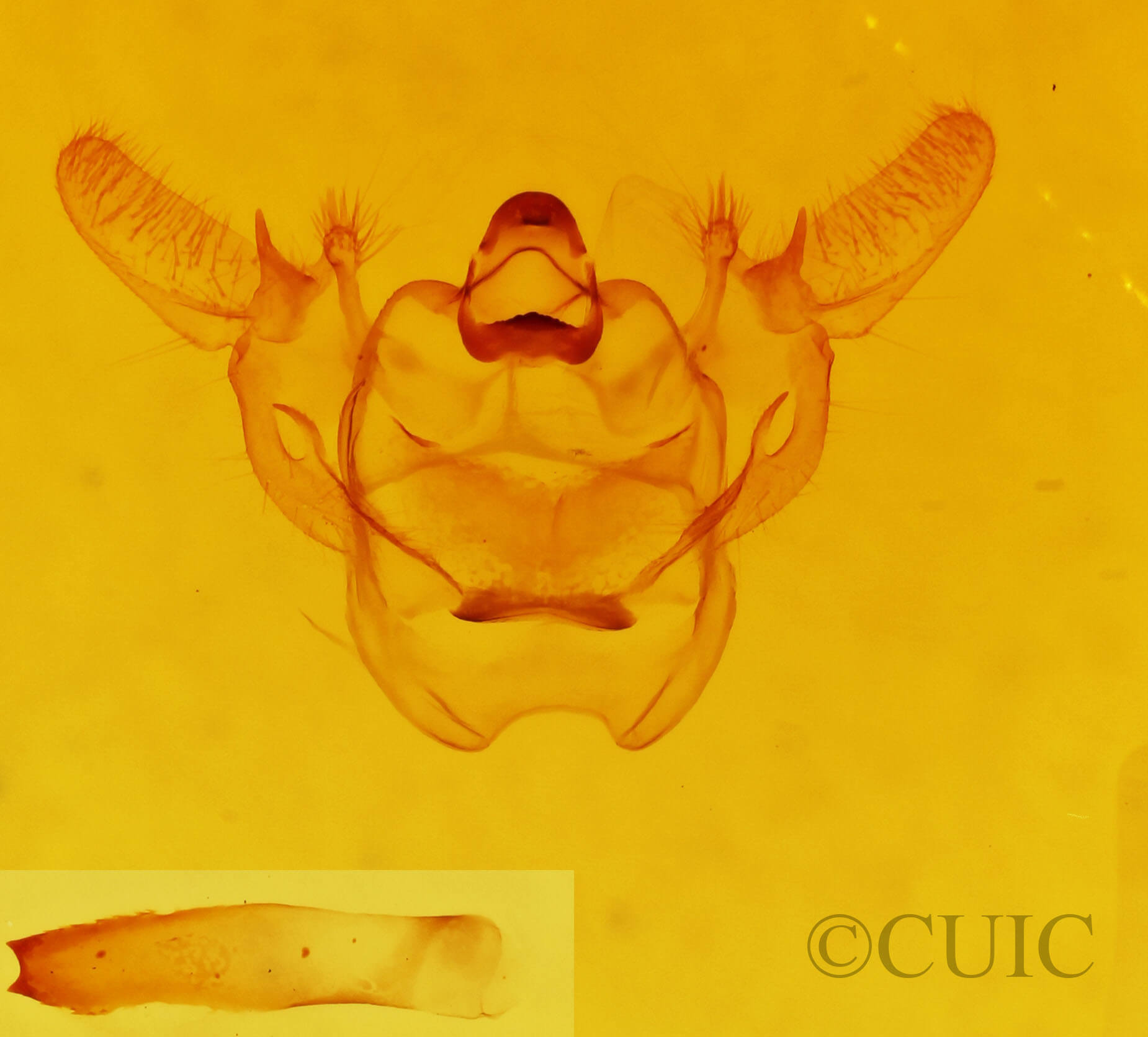 genitalia view of adult Xanthotype urticaria