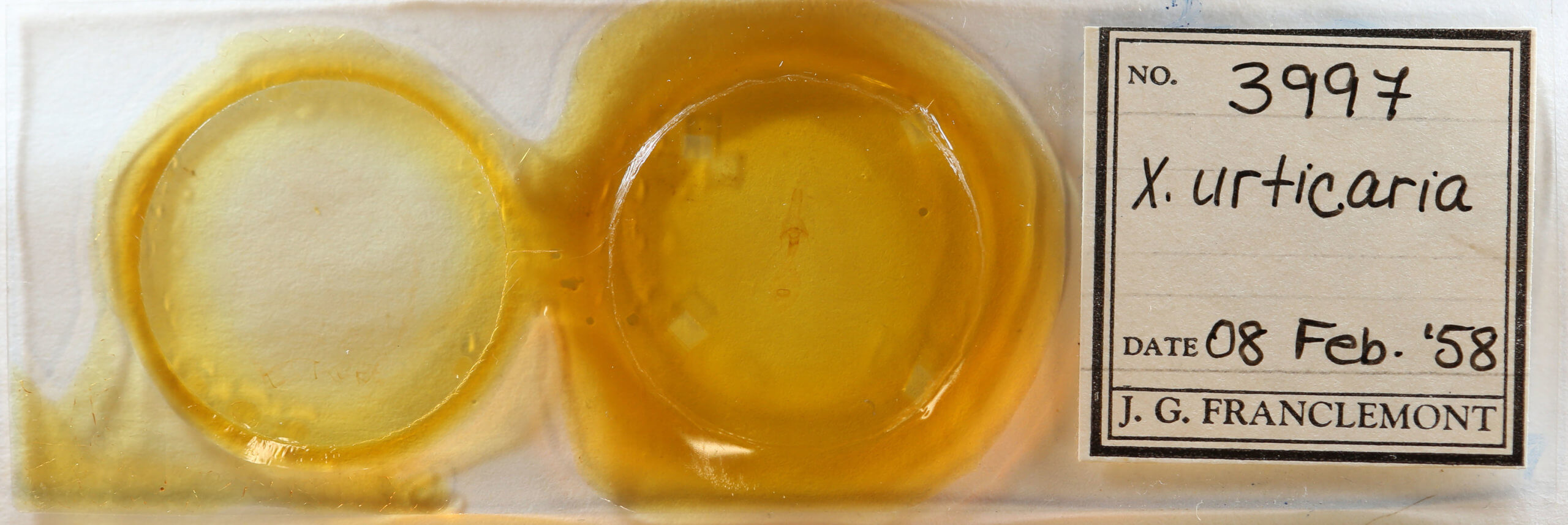 slide view of adult Xanthotype urticaria