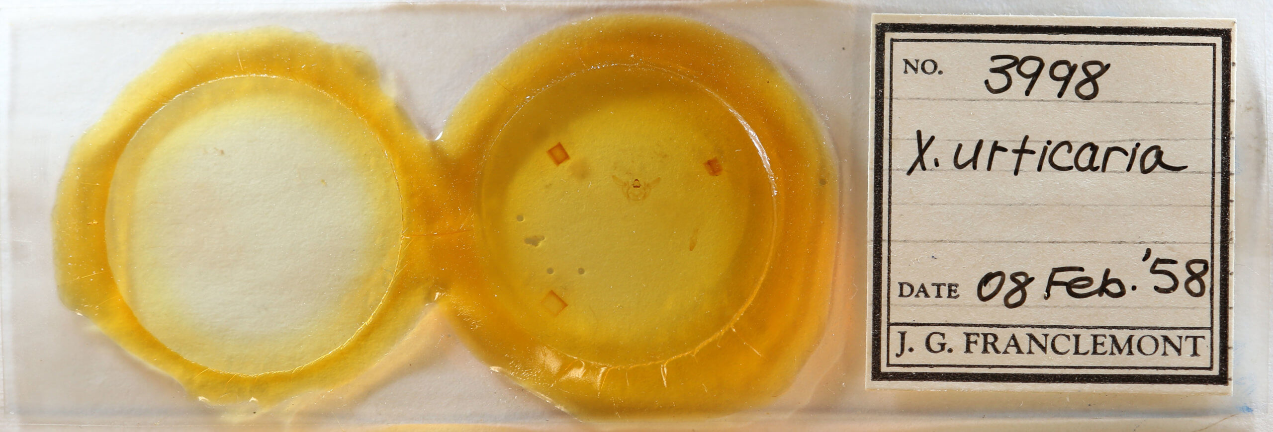 slide view of adult Xanthotype urticaria