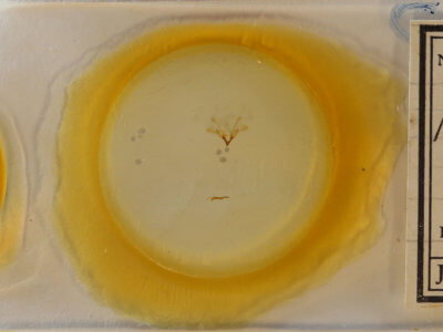 slide view of adult Nola cilicoides