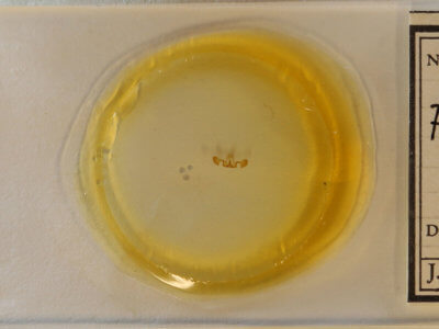 slide view of adult Retinia