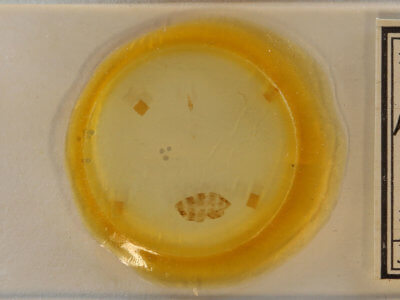 slide view of adult Laetilia myersella