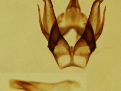 genitalia view of adult Argyria