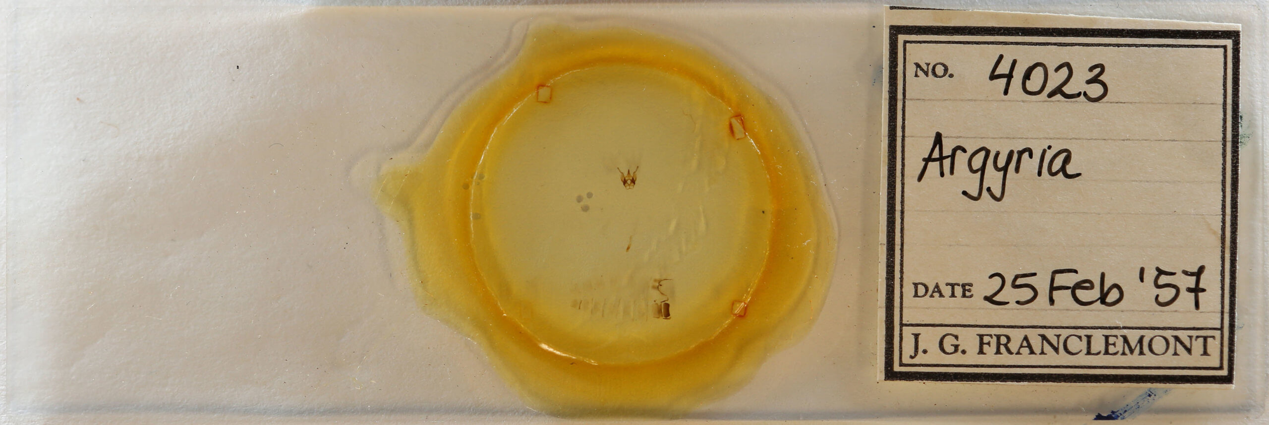 slide view of adult Argyria