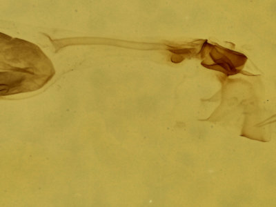 genitalia view of adult Argyria