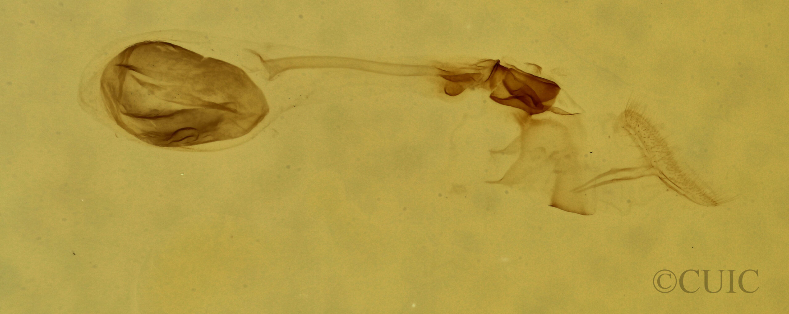 genitalia view of adult Argyria