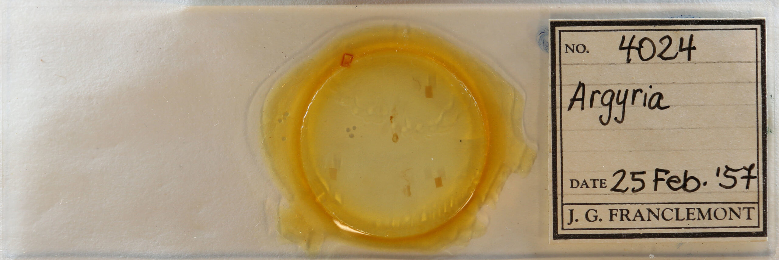 slide view of adult Argyria