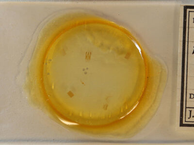 slide view of adult Argyria