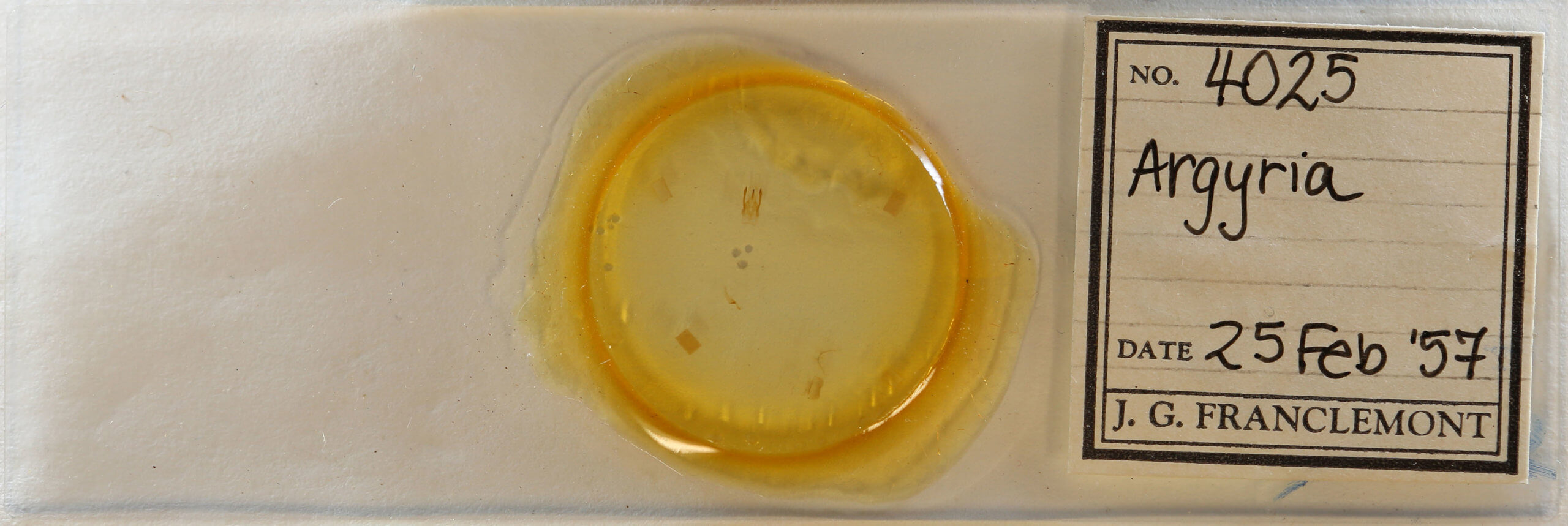 slide view of adult Argyria