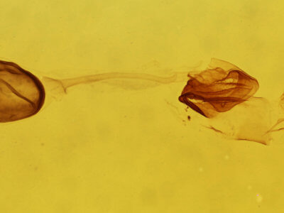 genitalia view of adult Argyria