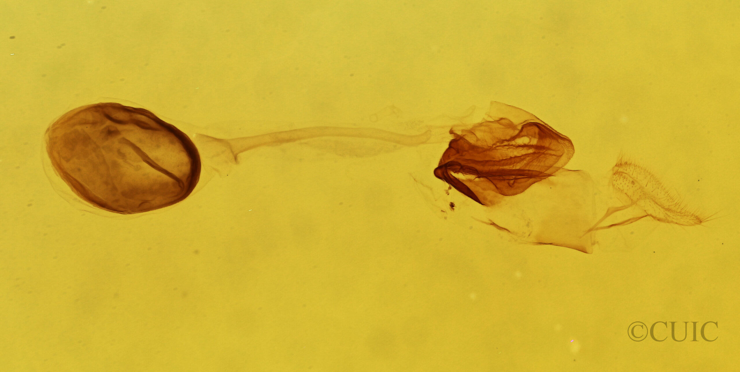 genitalia view of adult Argyria