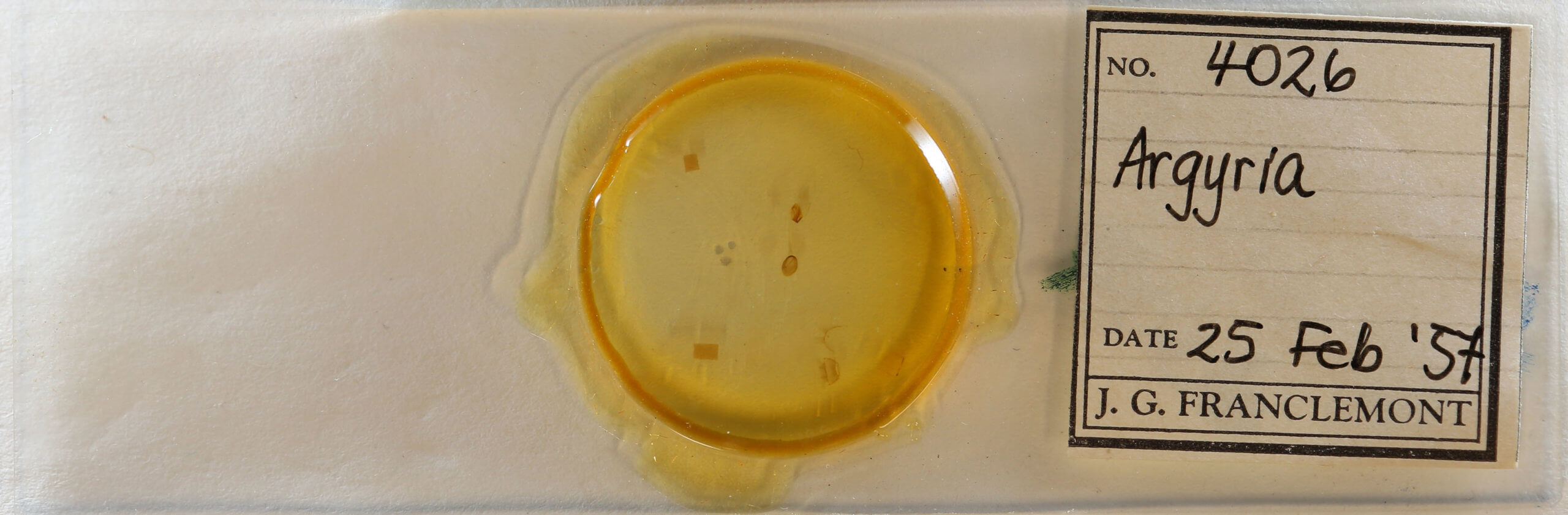 slide view of adult Argyria