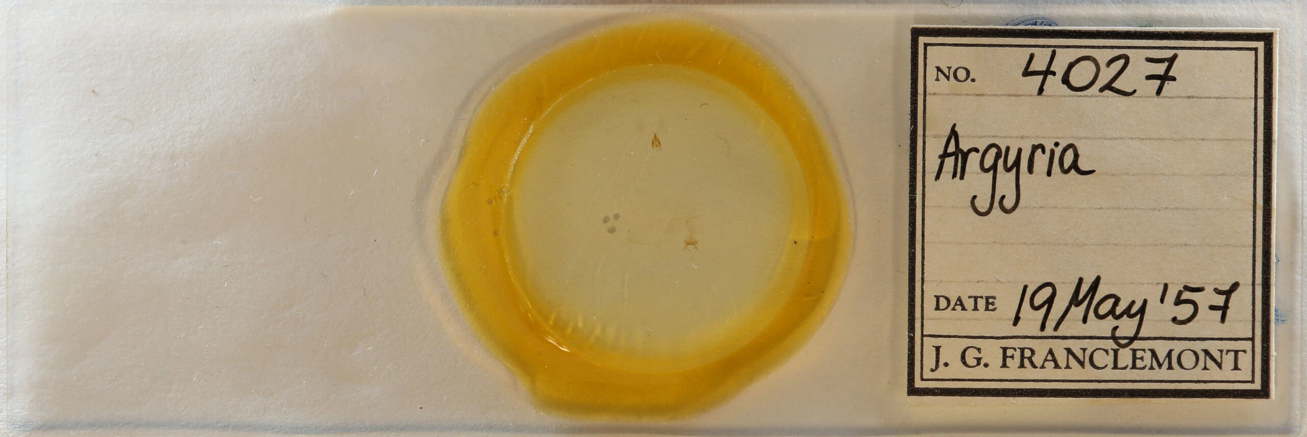 slide view of adult Argyria