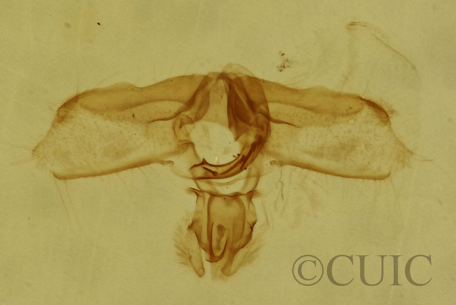 genitalia view of adult Acleris subnivana