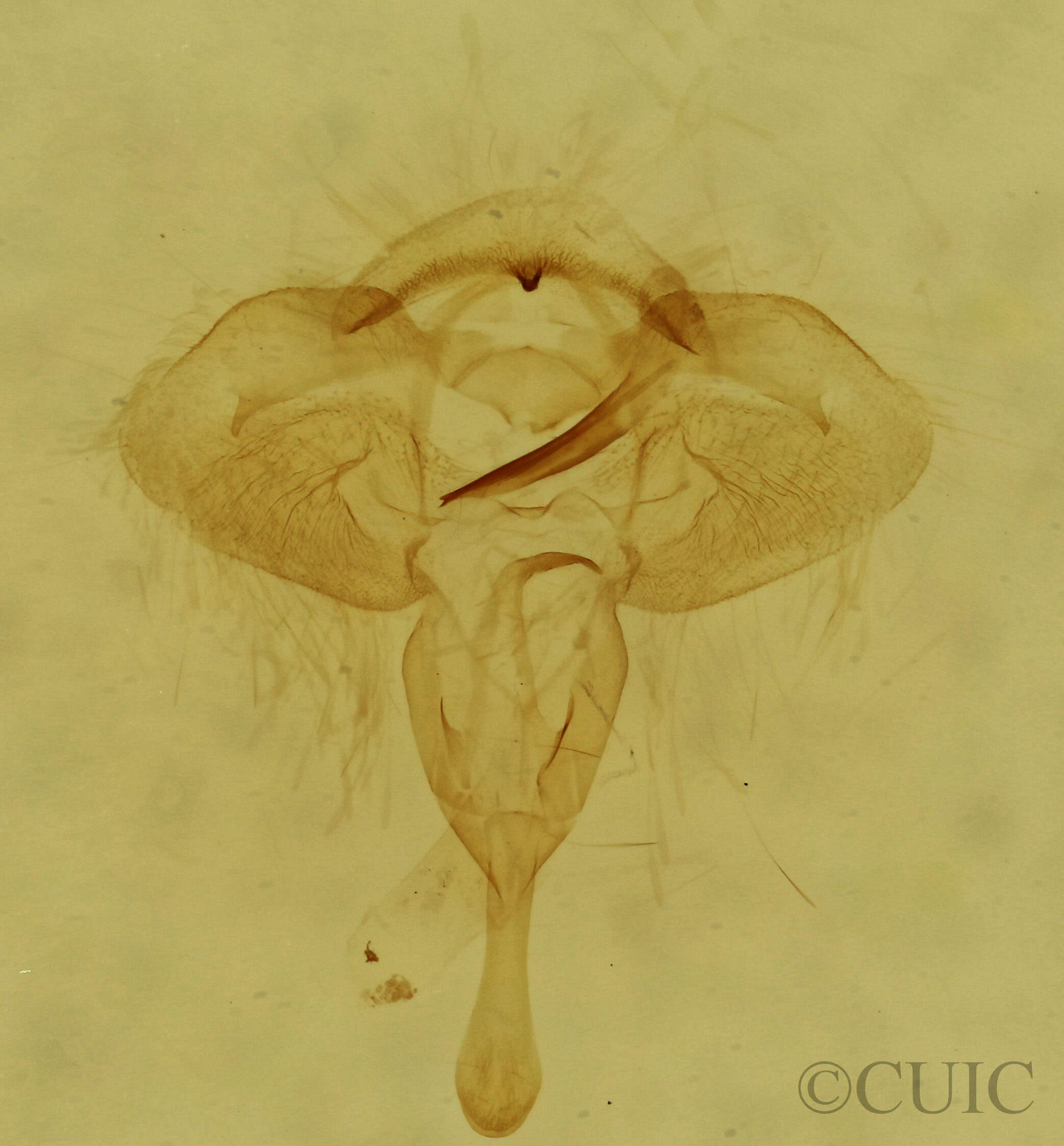 genitalia view of adult Archips grisea