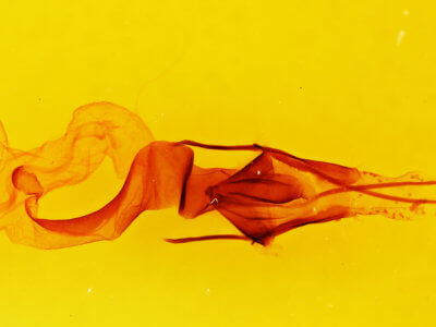 genitalia view of adult Lacinipolia teligera