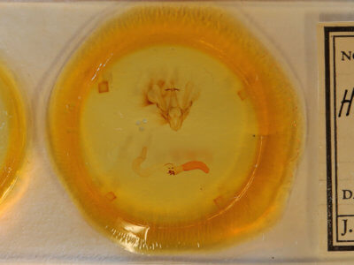 slide view of adult Hemicephalis characteria