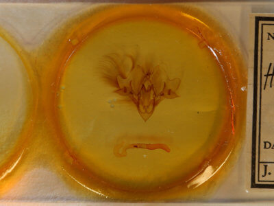 slide view of adult Hemicephalis