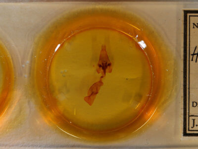 slide view of adult Hemicephalis