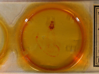 slide view of adult Arbostola