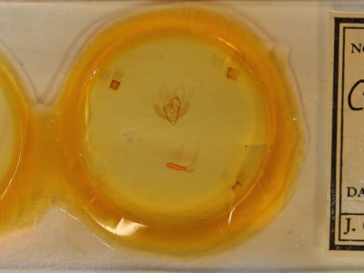 slide view of adult Cymatophoropsis trimaculata