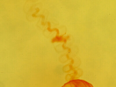 genitalia view of adult Nites maculatella