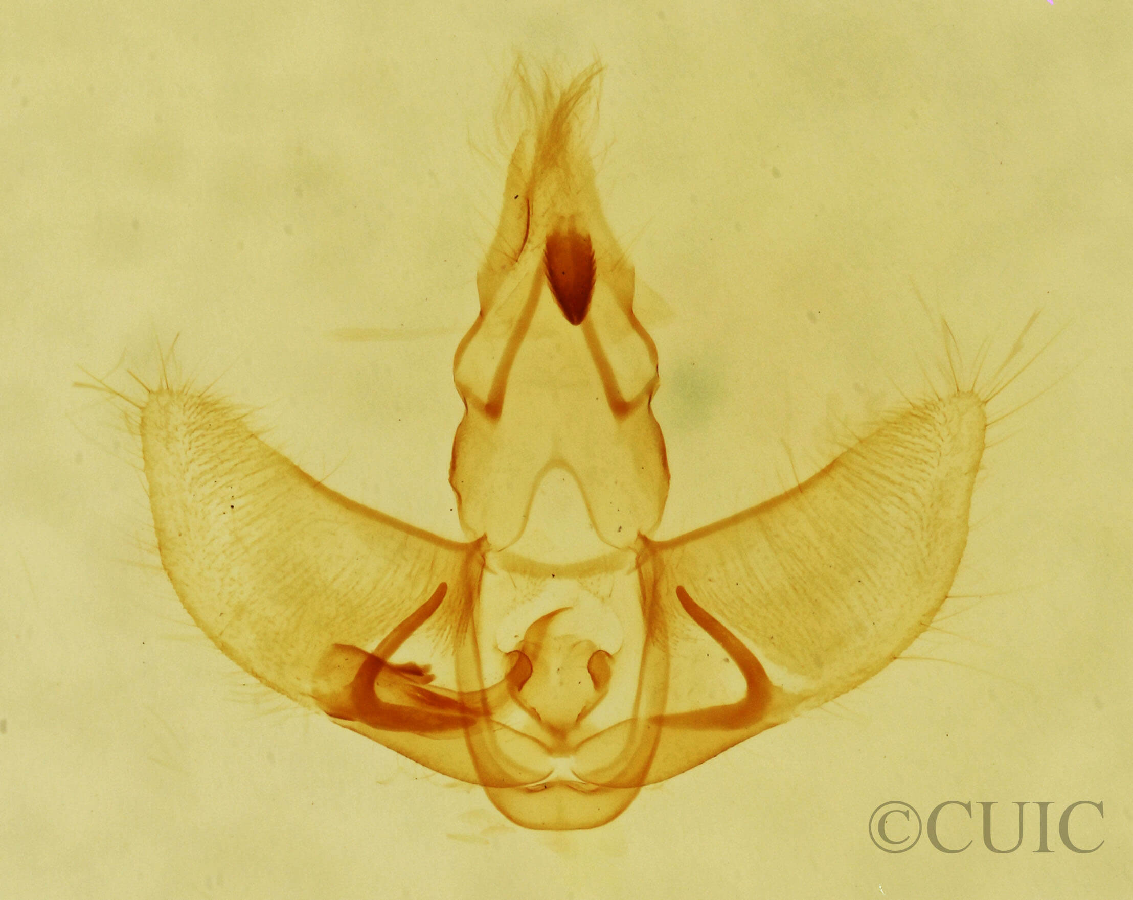genitalia view of adult Agonopterix pulvipennella
