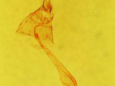 genitalia view of adult Agonopterix thelmae